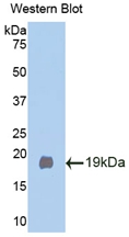 KLB / Beta Klotho Antibody - Western blot of KLB / Beta Klotho antibody.