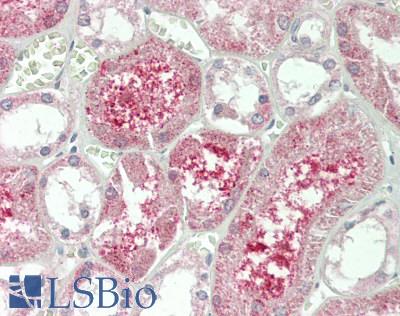 KLB / Beta Klotho Antibody - Human Kidney: Formalin-Fixed, Paraffin-Embedded (FFPE).  This image was taken for the unconjugated form of this product. Other forms have not been tested.