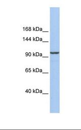 KLB / Beta Klotho Antibody - 721_B cell lysate. Antibody concentration: 1.0 ug/ml. Gel concentration: 6-18%.