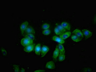KLB / Beta Klotho Antibody - Immunofluorescence staining of HepG2 cells with KLB Antibody at 1:66, counter-stained with DAPI. The cells were fixed in 4% formaldehyde, permeabilized using 0.2% Triton X-100 and blocked in 10% normal Goat Serum. The cells were then incubated with the antibody overnight at 4°C. The secondary antibody was Alexa Fluor 488-congugated AffiniPure Goat Anti-Rabbit IgG(H+L).