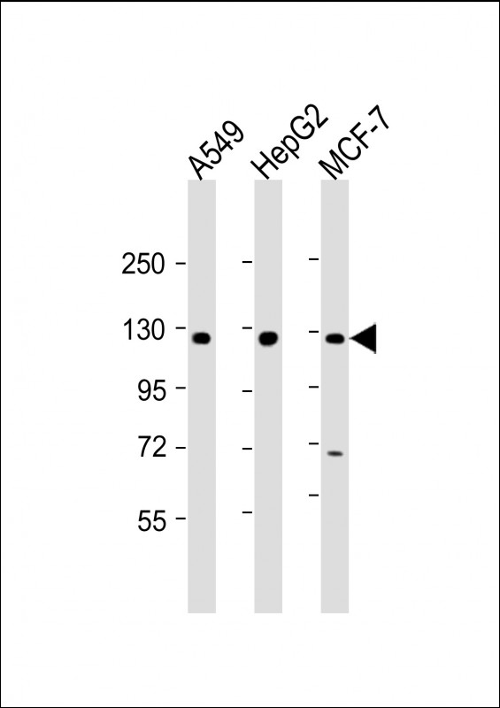 KLB / Beta Klotho Antibody - All lanes: Anti-KLB Antibody (N-Term) at 1:2000 dilution Lane 1: A549 whole cell lysate Lane 2: HepG2 whole cell lysate Lane 3: MCF-7 whole cell lysate Lysates/proteins at 20 µg per lane. Secondary Goat Anti-Rabbit IgG, (H+L), Peroxidase conjugated at 1/10000 dilution. Predicted band size: 120 kDa Blocking/Dilution buffer: 5% NFDM/TBST.
