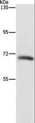 KLC1 / Kinesin Light Chain 1 Antibody - Western blot analysis of Lovo cell, using KLC1 Polyclonal Antibody at dilution of 1:550.