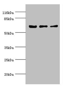 KLC1 / Kinesin Light Chain 1 Antibody - Western blot All Lanes:KLC1 antibody at 1.34ug/ml Lane 1:COLO 320 whole cell lysate Lane 2:HepG2 whole cell lysate Lane 3:SH-SY5Y whole cell lysate Secondary Goat polyclonal to rabbit at 1/10000 dilution Predicted band size: 66,64,65,72,70,67,63,73 kDa Observed band size: 65 kDa