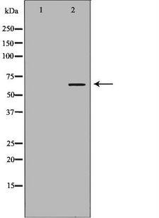 KLC1 / Kinesin Light Chain 1 Antibody - Western blot analysis of mouse brain lysate using KLC1 antibody. The lane on the left is treated with the antigen-specific peptide.