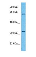 KLC1 / Kinesin Light Chain 1 Antibody - Western blot of KLC1 Antibody with human MCF7 Whole Cell lysate.  This image was taken for the unconjugated form of this product. Other forms have not been tested.