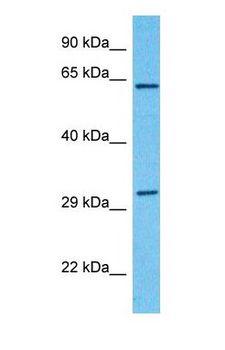 KLC1 / Kinesin Light Chain 1 Antibody - Western blot of KLC1 Antibody with human MCF7 Whole Cell lysate.  This image was taken for the unconjugated form of this product. Other forms have not been tested.