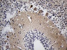 KLC2 Antibody - Immunohistochemical staining of paraffin-embedded Human embryonic cerebellum within the normal limits using anti-KLC2 mouse monoclonal antibody. (Heat-induced epitope retrieval by 1mM EDTA in 10mM Tris buffer. (pH8.5) at 120°C for 3 min. (1:2000)