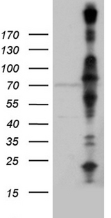 KLC2 Antibody - HEK293T cells were transfected with the pCMV6-ENTRY control. (Left lane) or pCMV6-ENTRY KLC2. (Right lane) cDNA for 48 hrs and lysed