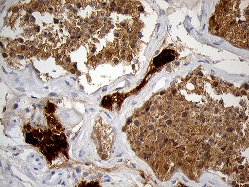 KLC2 Antibody - Immunohistochemical staining of paraffin-embedded Human testicle tissue within the normal limits using anti-KLC2 mouse monoclonal antibody. (Heat-induced epitope retrieval by 1mM EDTA in 10mM Tris buffer. (pH8.5) at 120°C for 3 min. (1:2000)