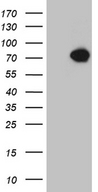 KLC2 Antibody - HEK293T cells were transfected with the pCMV6-ENTRY control. (Left lane) or pCMV6-ENTRY KLC2. (Right lane) cDNA for 48 hrs and lysed