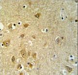 KLC2 Antibody - KLC2 Antibody IHC of formalin-fixed and paraffin-embedded brain tissue followed by peroxidase-conjugated secondary antibody and DAB staining.