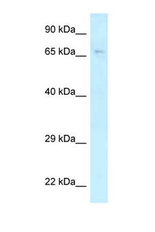 KLC2 Antibody - KLC2 antibody Western blot of MCF7 Cell lysate. Antibody concentration 1 ug/ml.  This image was taken for the unconjugated form of this product. Other forms have not been tested.
