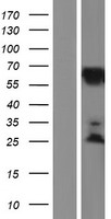 KLC2 Protein - Western validation with an anti-DDK antibody * L: Control HEK293 lysate R: Over-expression lysate