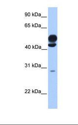 KLC3 Antibody - Fetal brain lysate. Antibody concentration: 1.0 ug/ml. Gel concentration: 12%.  This image was taken for the unconjugated form of this product. Other forms have not been tested.