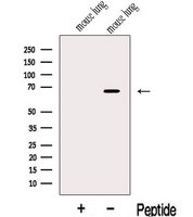 KLC3 Antibody - Western blot analysis of extracts of mouse lung tissue using KLC2 antibody. The lane on the left was treated with blocking peptide.