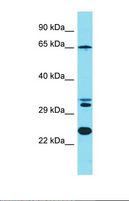 KLC4 Antibody - Western blot of Human Jurkat. KLC4 antibody dilution 1.0 ug/ml.  This image was taken for the unconjugated form of this product. Other forms have not been tested.