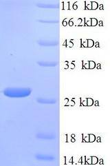 blaNDM-1 / Metallo-beta-Lactam Protein
