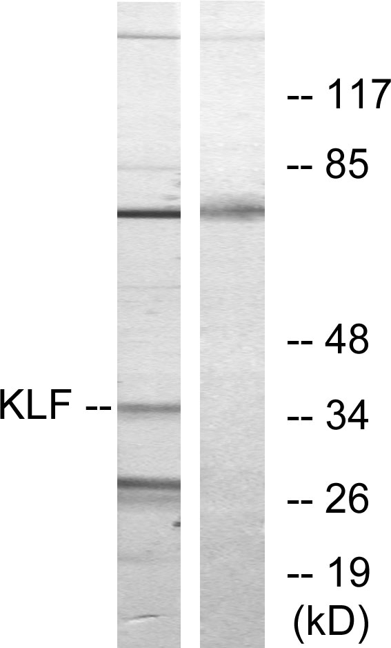 KLF / Kruppel-Like Factor Antibody - Western blot analysis of lysates from Jurkat cells, treated with serum 20% 15', using KLF Antibody. The lane on the right is blocked with the synthesized peptide.