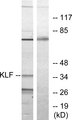 KLF / Kruppel-Like Factor Antibody - Western blot analysis of lysates from Jurkat cells, treated with serum 20% 15', using KLF Antibody. The lane on the right is blocked with the synthesized peptide.