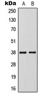 KLF1 + KLF5 + KLF7 Antibody - Western blot analysis of KLF1/5/7 expression in Jurkat (A); VEC (B) whole cell lysates.