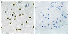 KLF10 + KLF11 Antibody - Immunohistochemistry analysis of paraffin-embedded human brain tissue, using KLF10/11 Antibody. The picture on the right is blocked with the synthesized peptide.