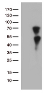 KLF11 Antibody - HEK293T cells were transfected with the pCMV6-ENTRY control. (Left lane) or pCMV6-ENTRY KLF11. (Right lane) cDNA for 48 hrs and lysed. Equivalent amounts of cell lysates. (5 ug per lane) were separated by SDS-PAGE and immunoblotted with anti-KLF11. (1:500)