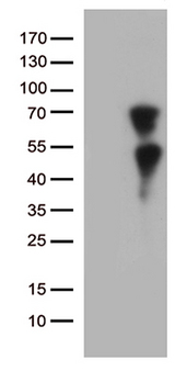 KLF11 Antibody - HEK293T cells were transfected with the pCMV6-ENTRY control. (Left lane) or pCMV6-ENTRY KLF11. (Right lane) cDNA for 48 hrs and lysed