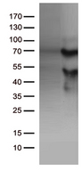 KLF11 Antibody - HEK293T cells were transfected with the pCMV6-ENTRY control. (Left lane) or pCMV6-ENTRY KLF11. (Right lane) cDNA for 48 hrs and lysed. Equivalent amounts of cell lysates. (5 ug per lane) were separated by SDS-PAGE and immunoblotted with anti-KLF11. (1:500)