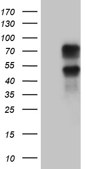 KLF11 Antibody - HEK293T cells were transfected with the pCMV6-ENTRY control. (Left lane) or pCMV6-ENTRY KLF11. (Right lane) cDNA for 48 hrs and lysed. Equivalent amounts of cell lysates. (5 ug per lane) were separated by SDS-PAGE and immunoblotted with anti-KLF11. (1:2000)
