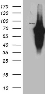 KLF11 Antibody - HEK293T cells were transfected with the pCMV6-ENTRY control. (Left lane) or pCMV6-ENTRY KLF11. (Right lane) cDNA for 48 hrs and lysed