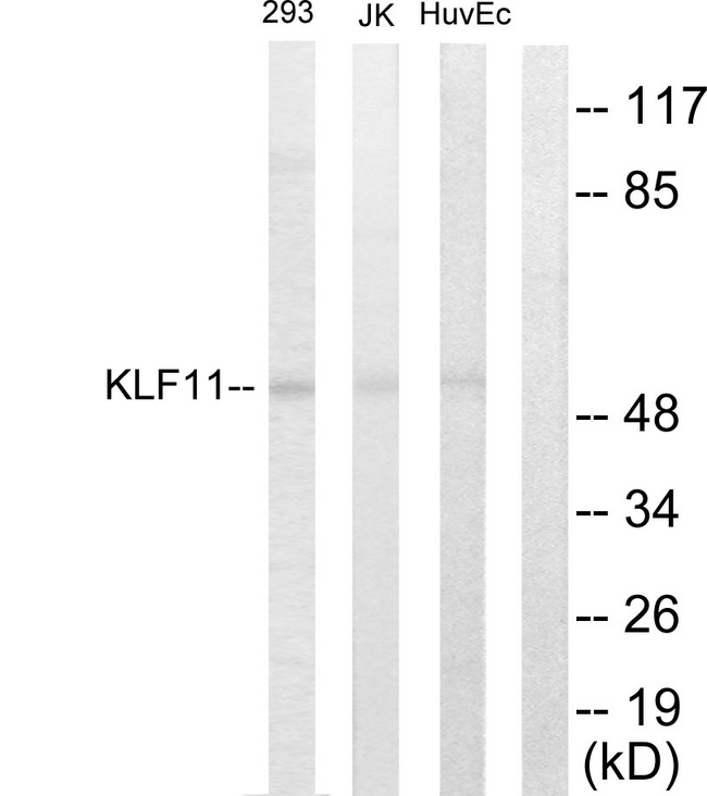 KLF11 Antibody - Western blot analysis of lysates from 293, Jurkat, and HUVEC cells, using KLF11 Antibody. The lane on the right is blocked with the synthesized peptide.