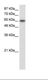 KLF11 Antibody - Transfected 293T Cell Lysate.  This image was taken for the unconjugated form of this product. Other forms have not been tested.