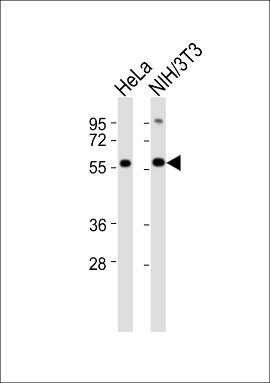 KLF11 Antibody - All lanes : Anti-KLF11 Antibody at 1:1000 dilution Lane 1: HeLa whole cell lysates Lane 2: NIH/3T3 whole cell lysates Lysates/proteins at 20 ug per lane. Secondary Goat Anti-Rabbit IgG, (H+L),Peroxidase conjugated at 1/10000 dilution Predicted band size : 55 kDa Blocking/Dilution buffer: 5% NFDM/TBST.