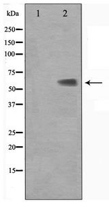 KLF11 Antibody - Western blot of Jurkat cell lysate using KLF11 Antibody