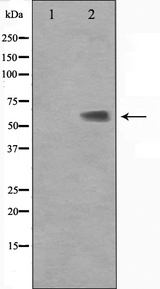 KLF11 Antibody - Western blot analysis on Jurkat cell lysates using KLF11 antibody. The lane on the left is treated with the antigen-specific peptide.