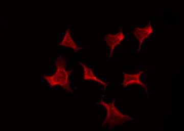 KLF11 Antibody - Staining 293 cells by IF/ICC. The samples were fixed with PFA and permeabilized in 0.1% Triton X-100, then blocked in 10% serum for 45 min at 25°C. The primary antibody was diluted at 1:200 and incubated with the sample for 1 hour at 37°C. An Alexa Fluor 594 conjugated goat anti-rabbit IgG (H+L) Ab, diluted at 1/600, was used as the secondary antibody.