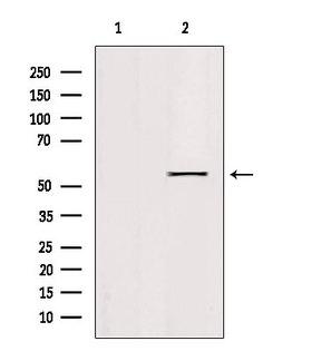 KLF11 Antibody - Western blot analysis of extracts of 293 cells using KLF11 antibody. Lane 1 was treated with the blocking peptide.