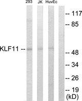 KLF11 Antibody - Western blot analysis of extracts from 293 cells, Jurkat cells and HuvEc cells, using KLF11 antibody.