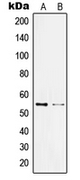 KLF11 Antibody - Western blot analysis of KLF11 expression in Jurkat (A); HL60 (B) whole cell lysates.