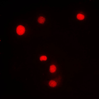 KLF11 Antibody - Immunofluorescent analysis of KLF11 staining in HL60 cells. Formalin-fixed cells were permeabilized with 0.1% Triton X-100 in TBS for 5-10 minutes and blocked with 3% BSA-PBS for 30 minutes at room temperature. Cells were probed with the primary antibody in 3% BSA-PBS and incubated overnight at 4 C in a humidified chamber. Cells were washed with PBST and incubated with a DyLight 594-conjugated secondary antibody (red) in PBS at room temperature in the dark. DAPI was used to stain the cell nuclei (blue).