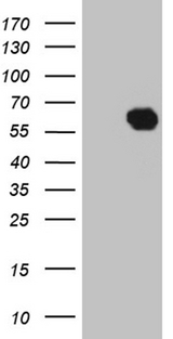 KLF12 Antibody - HEK293T cells were transfected with the pCMV6-ENTRY control. (Left lane) or pCMV6-ENTRY KLF12. (Right lane) cDNA for 48 hrs and lysed. Equivalent amounts of cell lysates. (5 ug per lane) were separated by SDS-PAGE and immunoblotted with anti-KLF12. (1:2000)