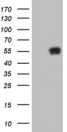 KLF12 Antibody - HEK293T cells were transfected with the pCMV6-ENTRY control. (Left lane) or pCMV6-ENTRY KLF12. (Right lane) cDNA for 48 hrs and lysed. Equivalent amounts of cell lysates. (5 ug per lane) were separated by SDS-PAGE and immunoblotted with anti-KLF12. (1:2000)