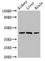 KLF12 Antibody - Western Blot Positive WB detected in:Mouse kidney tissue,Rat liver tissue,Rat brain tissue All Lanes:KLF12 antibody at 2.5µg/ml Secondary Goat polyclonal to rabbit IgG at 1/50000 dilution Predicted band size: 45,29,34 KDa Observed band size: 45 KDa