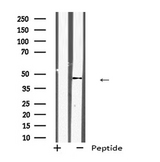 KLF12 Antibody - Western blot analysis of KLF12 expression in 293T whole cells lysate. The lane on the left is treated with the antigen-specific peptide.
