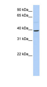 KLF12 Antibody - KLF12 antibody Western blot of 721_B cell lysate. This image was taken for the unconjugated form of this product. Other forms have not been tested.