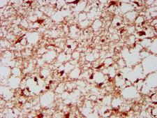 KLF13 Antibody - Immunohistochemistry image at a dilution of 1:300 and staining in paraffin-embedded human brain tissue performed on a Leica BondTM system. After dewaxing and hydration, antigen retrieval was mediated by high pressure in a citrate buffer (pH 6.0) . Section was blocked with 10% normal goat serum 30min at RT. Then primary antibody (1% BSA) was incubated at 4 °C overnight. The primary is detected by a biotinylated secondary antibody and visualized using an HRP conjugated SP system.