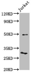 KLF13 Antibody - Positive Western Blot detected in Jurkat whole cell lysate. All lanes: KLF13 antibody at 4.2 µg/ml Secondary Goat polyclonal to rabbit IgG at 1/50000 dilution. Predicted band size: 32 KDa. Observed band size: 32 KDa
