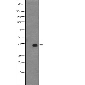 KLF14 / BTEB5 Antibody - Western blot analysis of KLF14 expression in A431 whole cells lysate. The lane on the left is treated with the antigen-specific peptide.