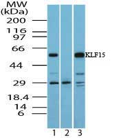 KLF15 Antibody - Western blot of KLF15 in human liver lysate in the 1) absence and 2) presence of immunizing peptide and 3) mouse liver lysate using Polyclonal Antibody to KLF15 at 1.0 ug/ml. Goat anti-rabbit Ig HRP secondary antibody, and PicoTect ECL substrate solution, were used for this test.