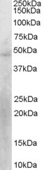 KLF15 Antibody - Antibody staining (0.3 ug/ml) of HepG2 lysate (RIPA buffer, 30 ug total protein per lane). Primary incubated for 12 hour. Detected by Western blot of chemiluminescence.